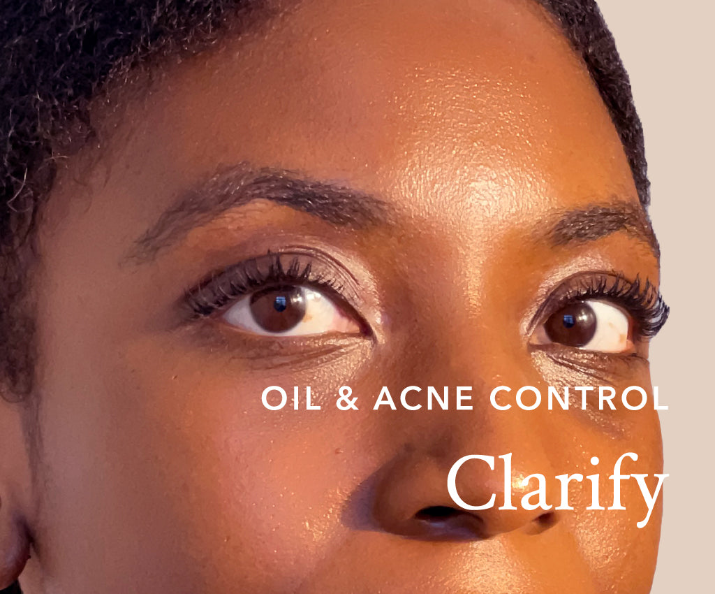 Akar Skin, model, female, woman, Clarify Collection, oil & acne control, model