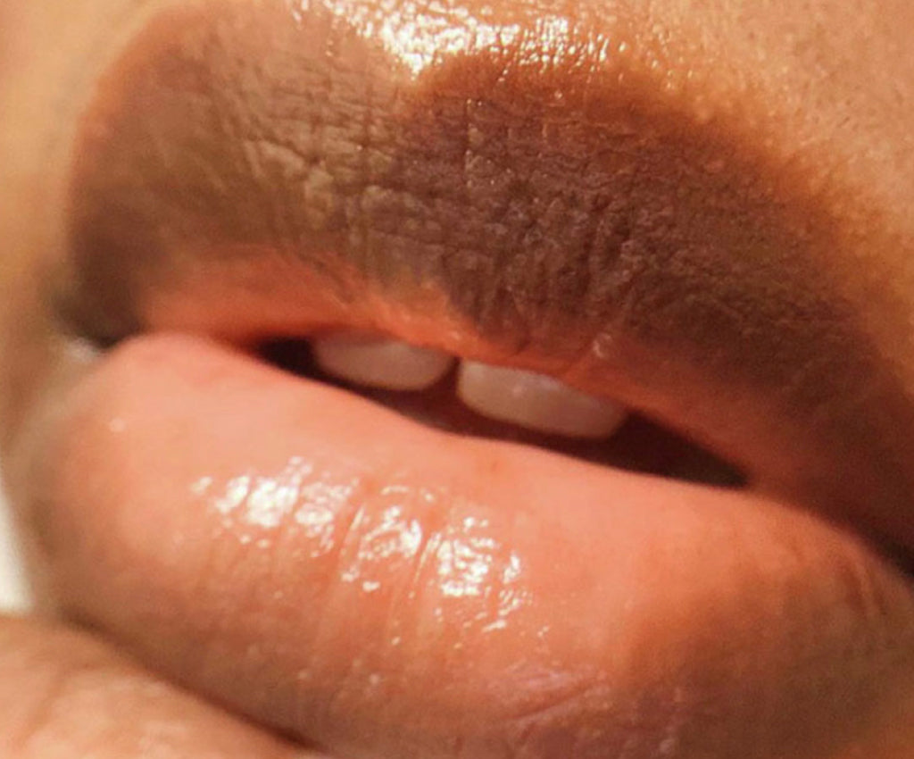 Akar Skin, pink lips, girl, mouth, skin, lip balm, glossy lips, hydrated lips, photography, clean beauty 